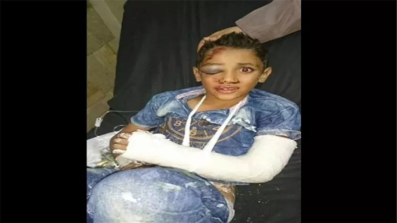 بالفيديو والصور.. لعبة 