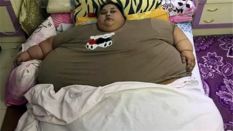 طبيب إيمان عبد العاطي يحذر من قرار نقلها إلى أبوظبي