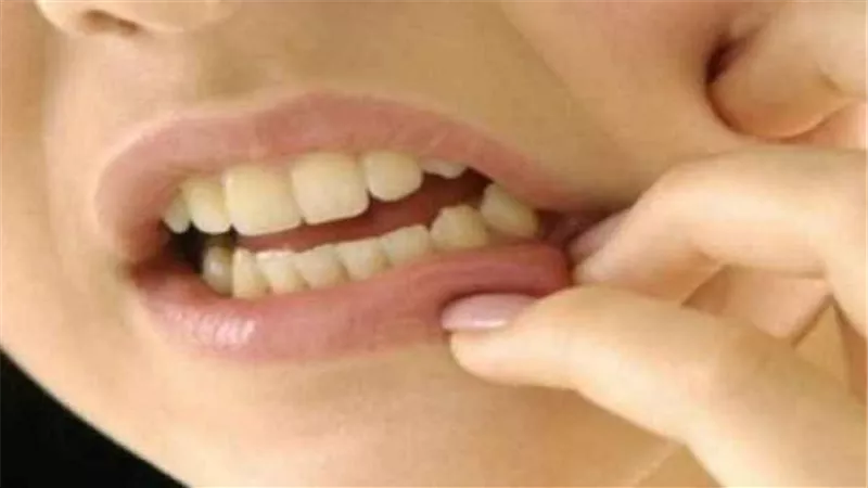 إحذر.. تلك المشروبات تؤدي إلى تآكل الأسنان