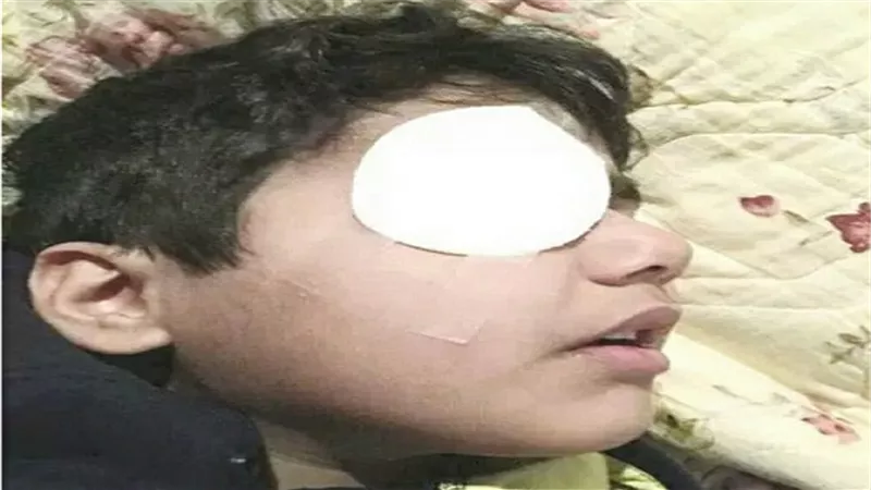طالب يفقأ عين زميله بمدرسة ببنها