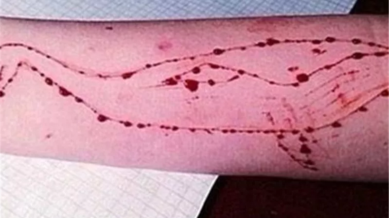 ناجي من لعبة الحوت الأزرق يروي تجربته.. ماذا قال؟