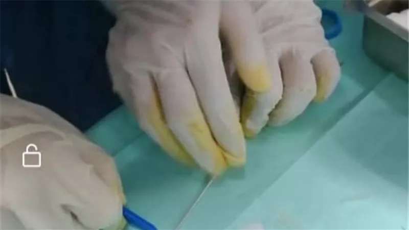 صحة الدقهلية.. توفير خدمة الغسيل الكلوي البروتوني للأطفال بمستشفى السنبلاوين العام