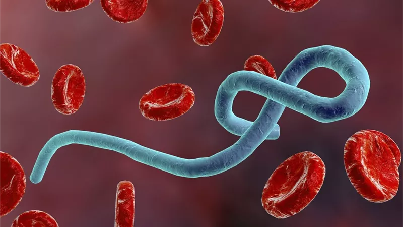 علامات مبكرة للإيبولا يمكن الخلط بينها وبين الإنفلونزا