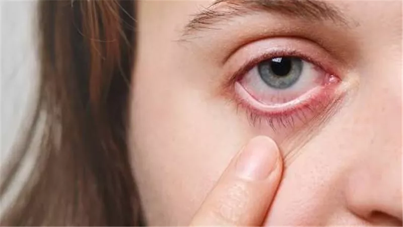 أسرار التغيّرات الهرمونية.. لماذا تصاب الحامل بجفاف العين؟
